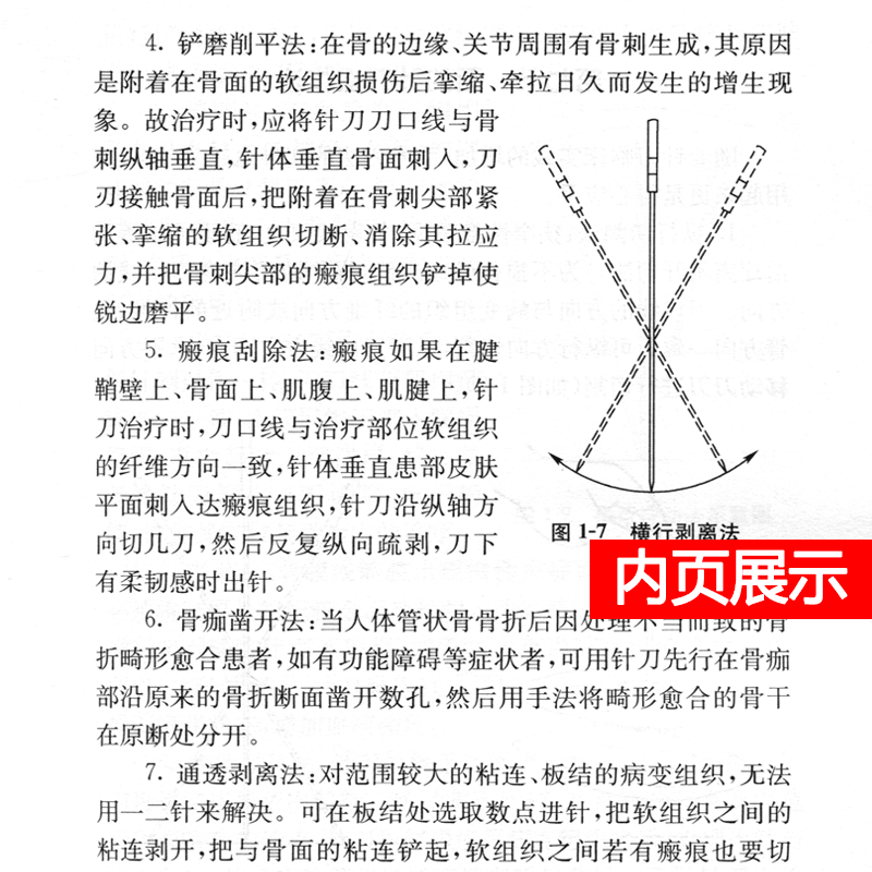 针刀临床诊断与治疗第二版朱汉章柳百智人民卫生实用小针刀书籍疗法治疗学基书籍医学自学入门中医针灸高清大图