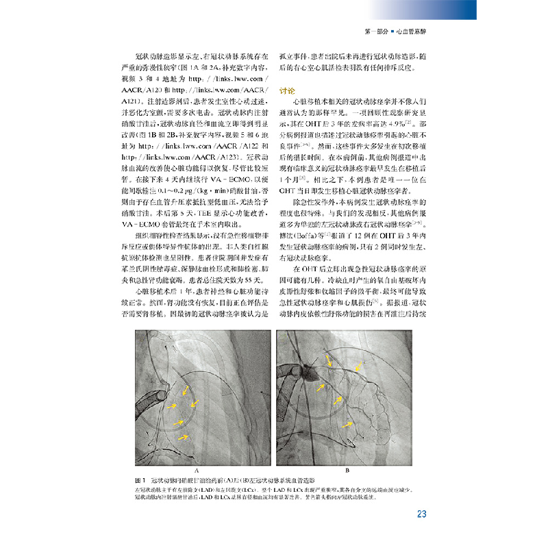 醉染图书麻醉与镇痛病例报道精选1009787519265717高清大图