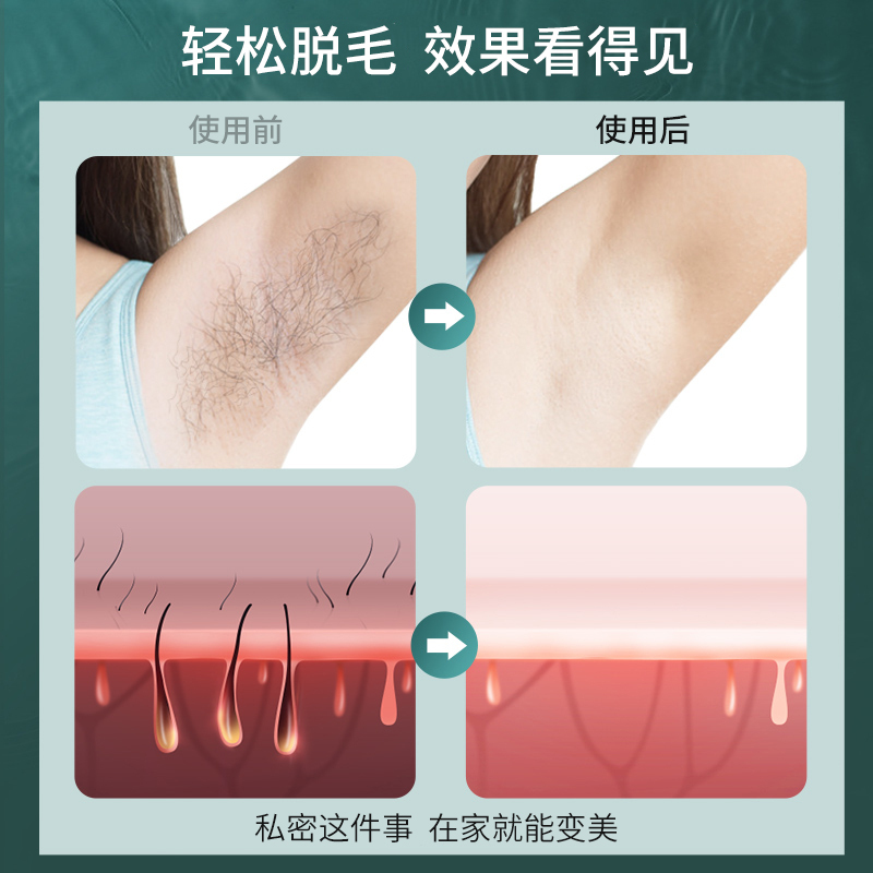 志高(CHIGO)冰点激光脱毛仪私处腋下腿毛唇毛脱毛器女士男通用脱毛仪器全身剃毛器光子家用美容脱毛机HC06白色