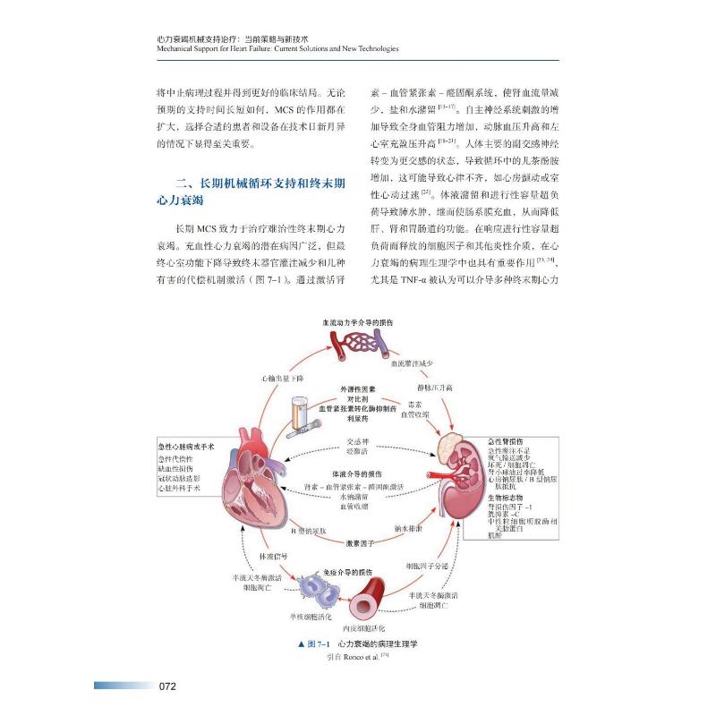 心力衰竭机械支持治疗:当前策略与新技术