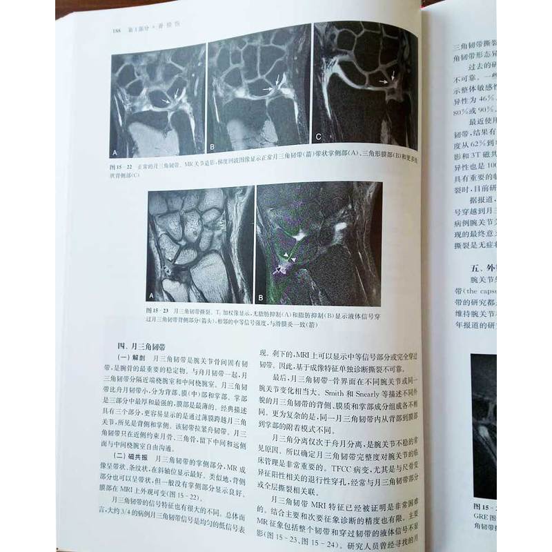 [醉染正版]新版 肌肉骨骼影像学 影像学大师系列实用骨骼肌肉奈特医学书籍 肌肉训练百科9787547837320肌肉骨骼高清大图