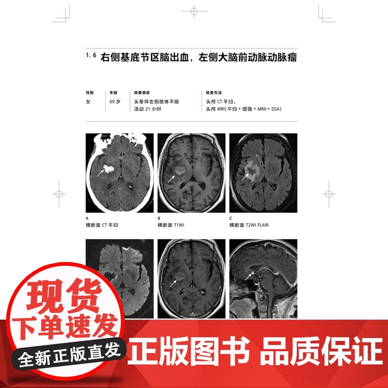 影像学典型病例诊断图谱 上海科学技术出版社汪登斌 张玉珍著放射科常见疾病特点影像诊断鉴别诊断分析提高诊别水平高清大图
