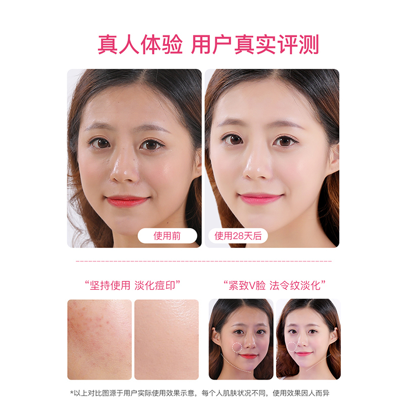 佳禾美嫩肤美容仪器家用脸部按摩洗脸仪清洁面部导出导入仪
