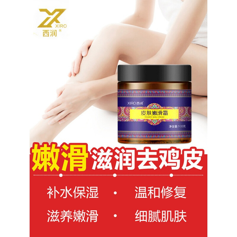 鱼鳞病皮肤霜去鱼鳞鸡皮肤毛囊角质疙瘩角化去除蛇皮鱼鳞腿部病干燥起皮全身体乳霜膏