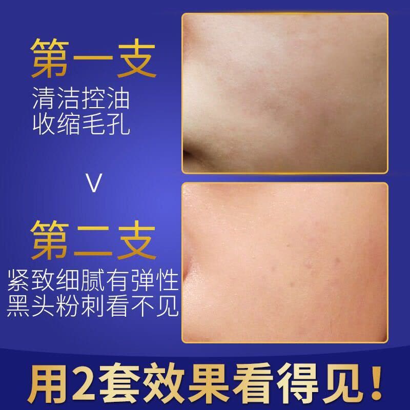 芦荟洗面奶补水保湿控油祛斑淡痘印收缩毛孔深层清洁面乳男女 三件套送面膜（洗面奶+精华乳+保湿露图片