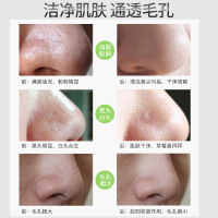 [20片]形象美竹炭去黑头面膜鼻膜贴T区护理