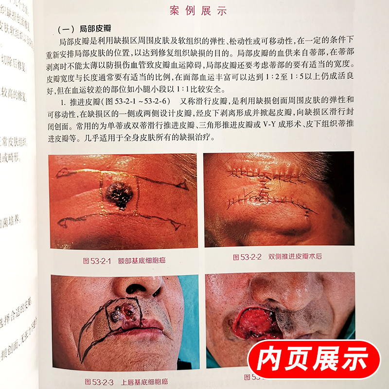 [正版]实用美容皮肤科学 何黎皮肤病痤疮激光修复科学护肤抗衰老医美面诊微整形斑问题敏感肌护理强脉冲光治疗人民卫生出版社高清大图