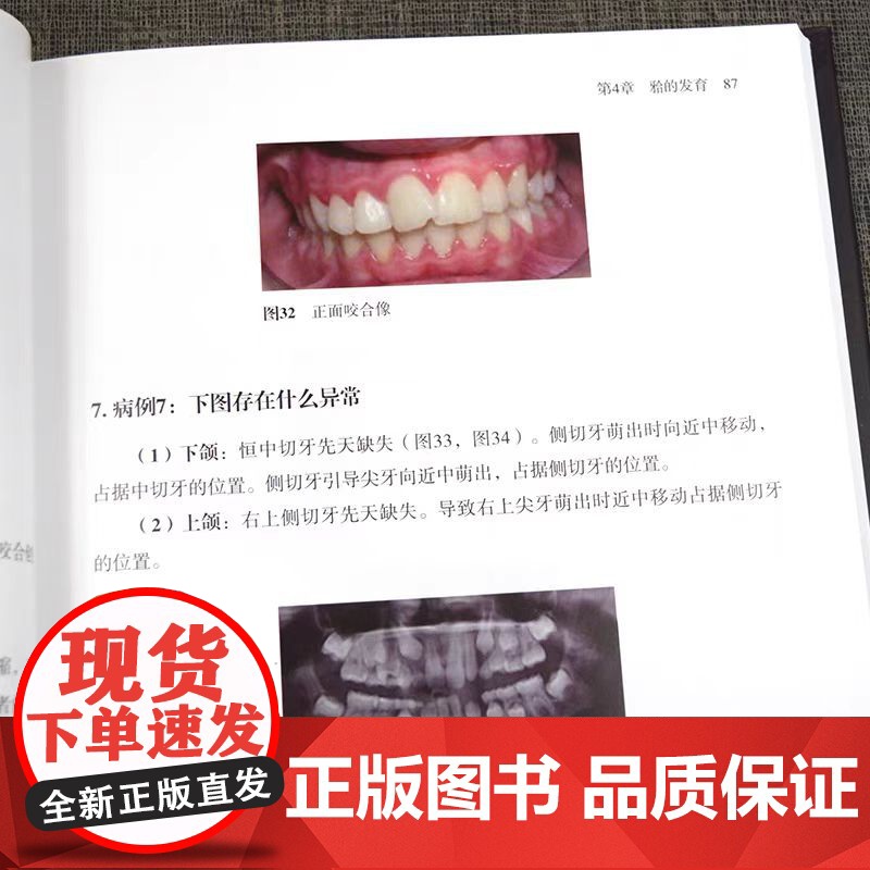 儿童正畸治疗策略与实践 乔治 利萨斯 编著 颅颌面生长发育 颌骨及牙列关系评估 面部软组织评估 辽宁科学技术出版社978高清大图