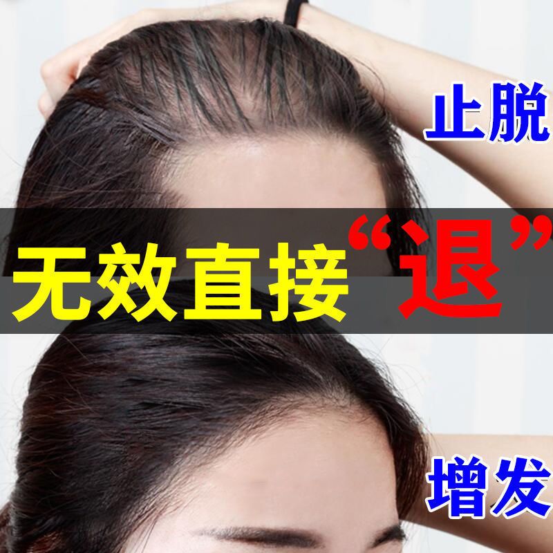 [生新发]育发生发剂增发密发育发液秃顶增长液快速变长头发 单瓶体验装[防脱加生发2000根] 当天生新发 不生发