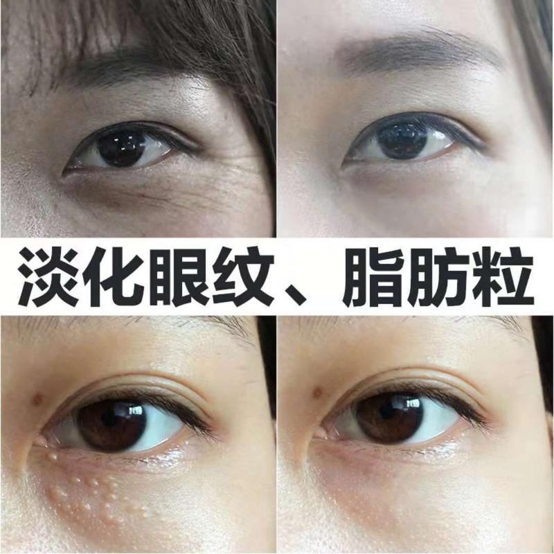 蜗牛精华眼霜25g淡化细纹去眼袋黑眼圈去脂肪粒提拉紧致抗皱单个