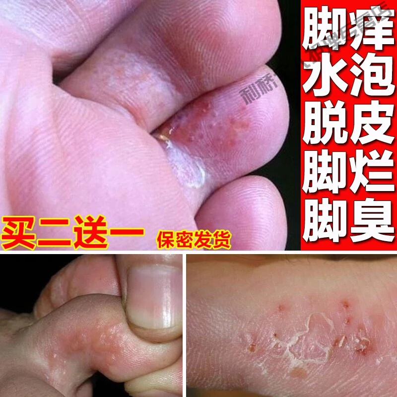 百年方陈脚堂膏足脚康王华福恩嗯套装气膏丁达尔参数