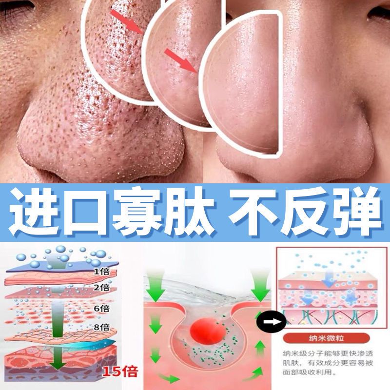小气泡寡肽面膜去黑头收缩毛孔深层清洁补水保湿睡眠涂抹男女通用 超大容量[四袋装]祛痘去闭口 [日本进口寡肽]小气泡面膜