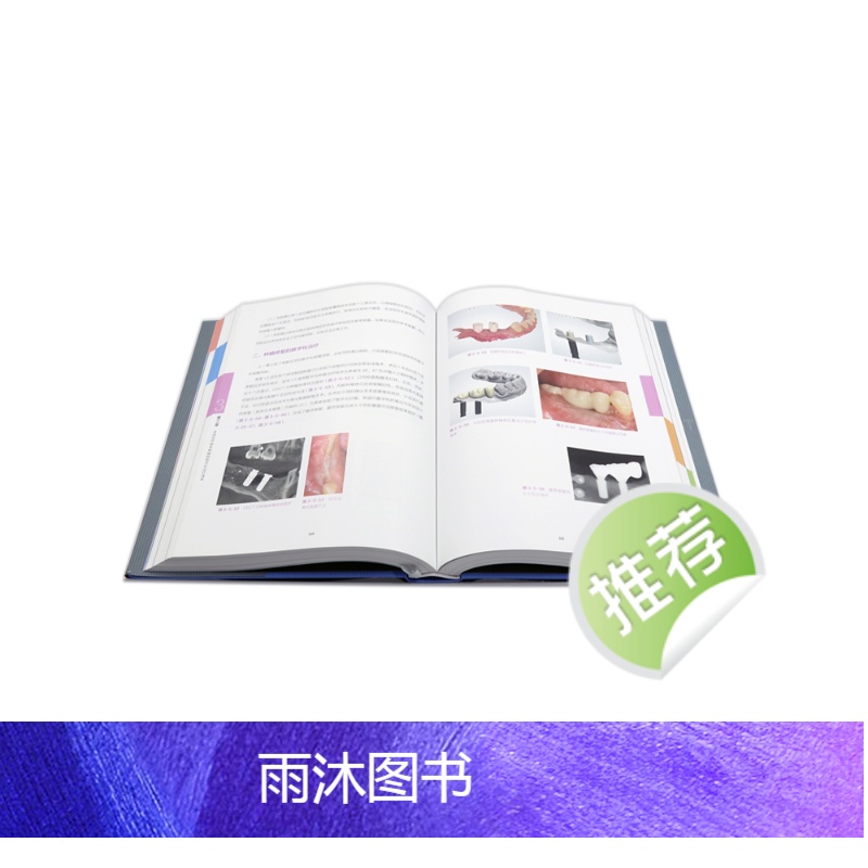 [正版]口腔种植规范化治疗清单 满毅单颗多颗牙植入精准二期手术和取模技巧课程专业零基础修复技术病例全口牙科牙医缝合医学高清大图