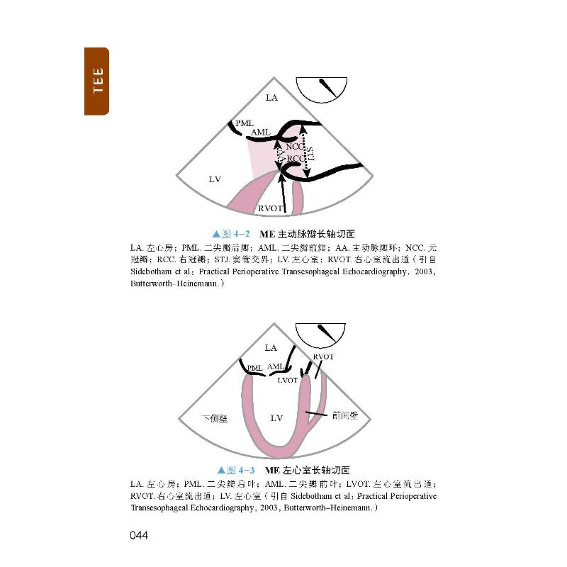 正版新书】TEE掌中宝 原书第2版(美)莱恩·格罗班,(美)钱德里卡·拉