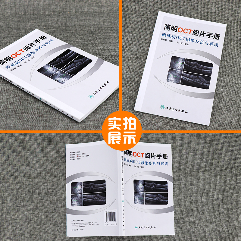 [正版] 简明OCT阅片手册 眼底病眼科OCT影像分析与解读 俞素勤编著 基础阅片影像眼科学视光技术应用 人民卫生出版高清大图