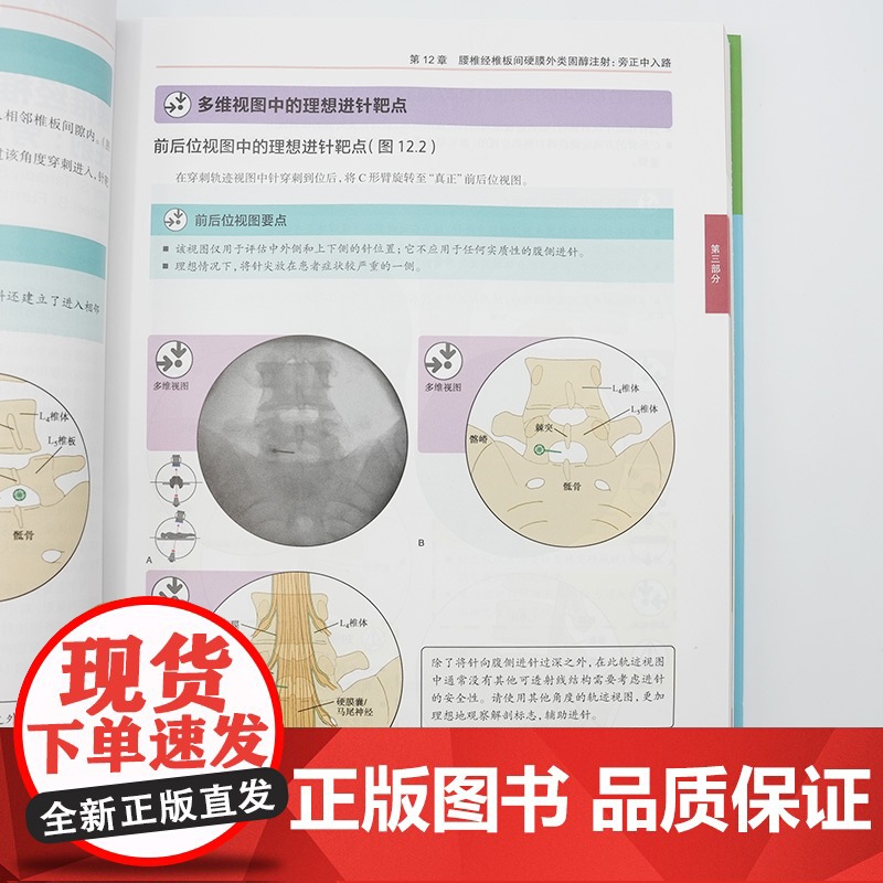 影像引导下脊柱介入操作图解 第2版 翻译版以图为主 文字简明扼要 介入程序每步以图文字结合说明欧美康复医师疼痛医师人民卫高清大图