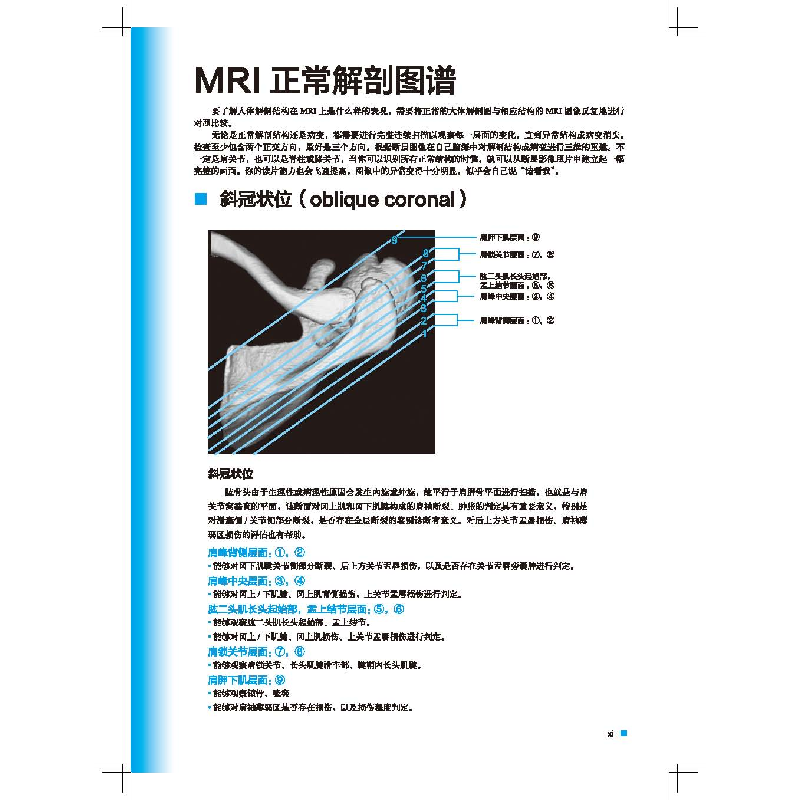 醉染图书肩关节磁共振诊断 第2版9787571411978高清大图