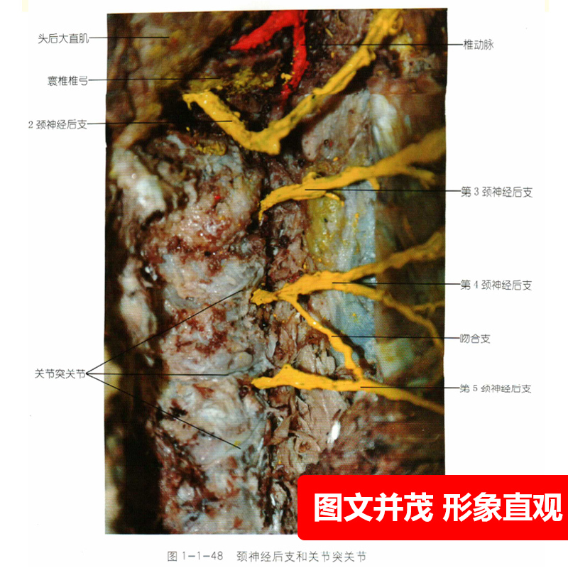 [正版]2册针刀应用解剖与临床上下卷册李石良中医针刀医学书籍应用临床解剖学书籍高清彩图线装书籍 颈项颜面肩肘教程彩图彩