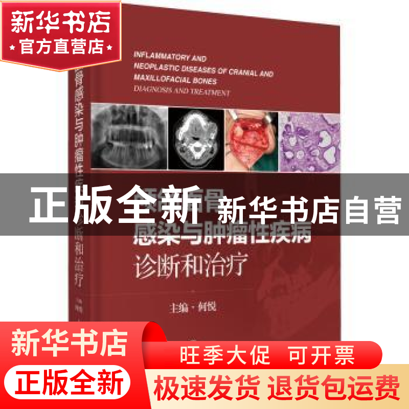 正版 颅颌面骨感染与肿瘤性疾病:诊断和治疗:diagnosis and treat高清大图