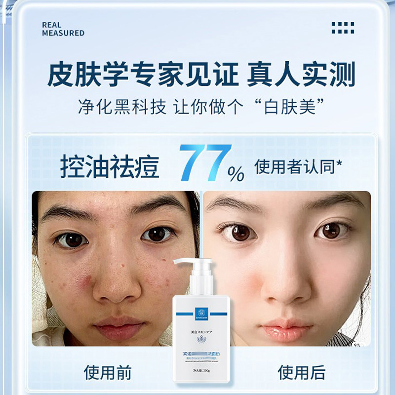 七绿氨基酸淡斑美白洗面奶改善黄皮肤清洁毛孔控油温和保湿不紧绷