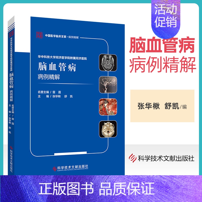 【正版】 华中科技大学同济医学院附属同济医院脑血管病病例精解 张华楸 舒凯 脑血管疾病病案 医学书籍 科学技术文献出版社