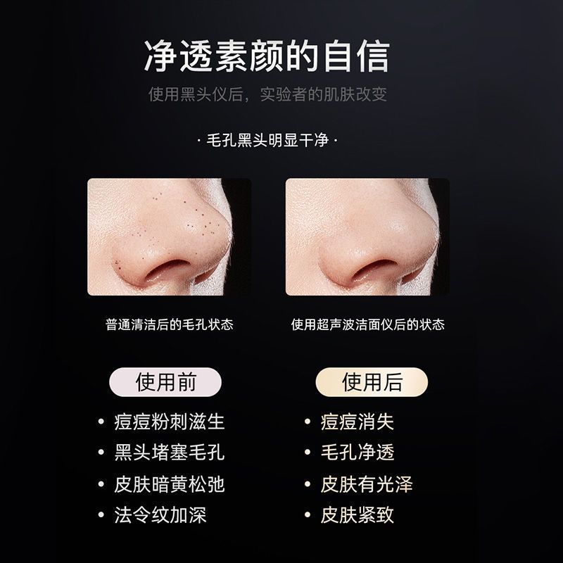 黑头铲超声波去黑头粉刺神器铲皮机脸部按摩器提拉紧致清洁不伤肤 基础款震动款(无雾化)-/*-/*