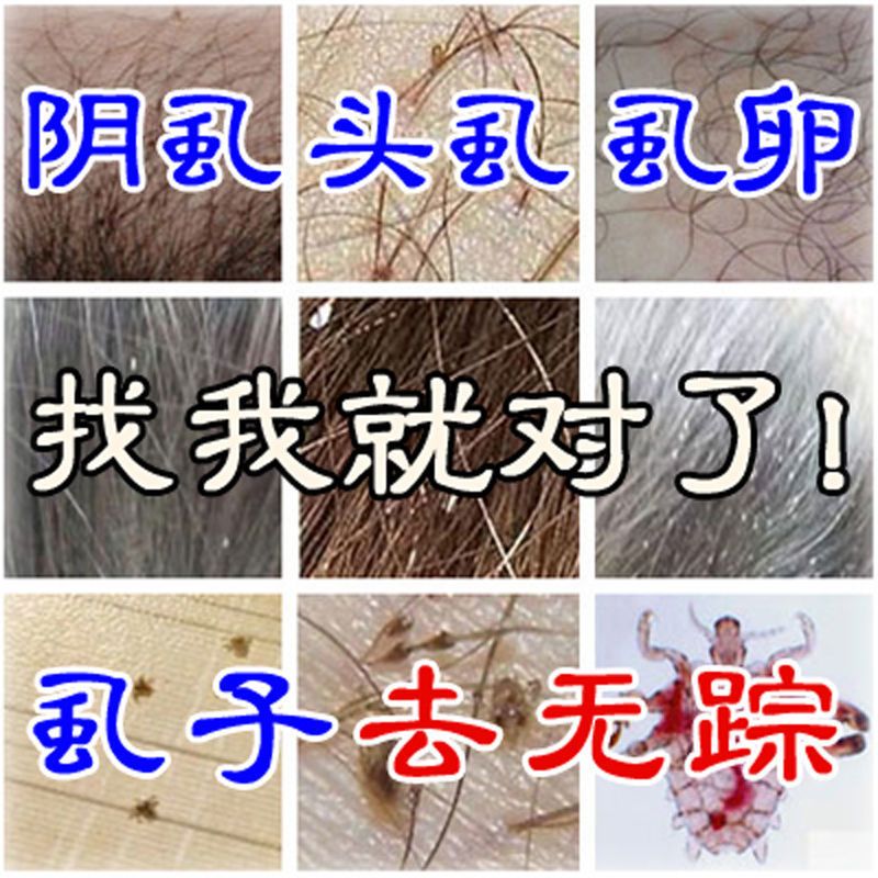 虱子药成人头部用阴虱除灭虱卵跳蚤头虱阴虱粉喷雾|三盒(买二送一)收藏产品优先发货