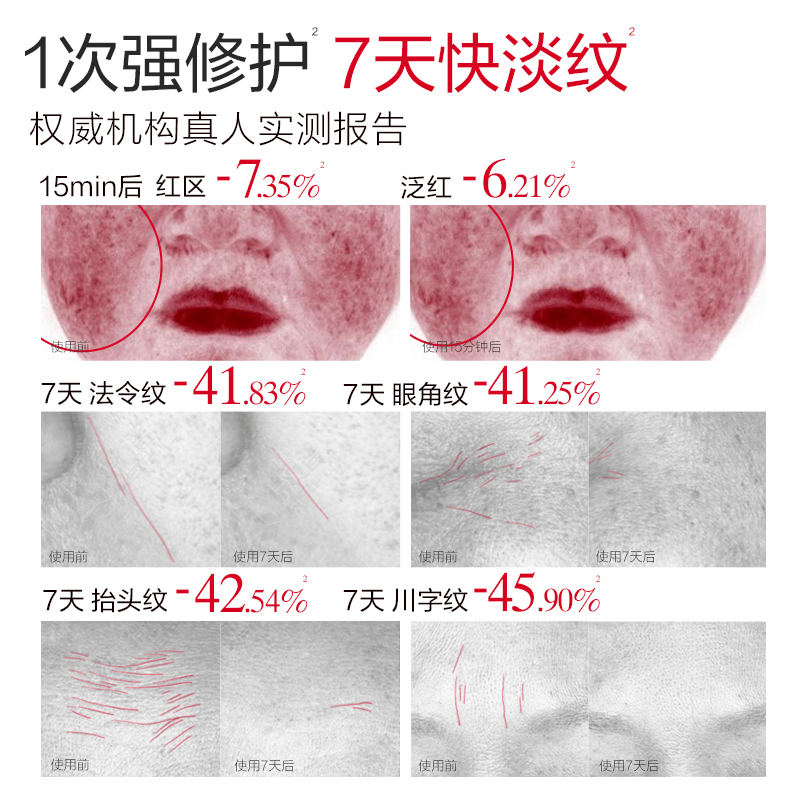 丸美 重组胶原蛋白抗皱修护次抛精华液1.5mlx30支+赠1.5mlx10支(共40支)高清大图