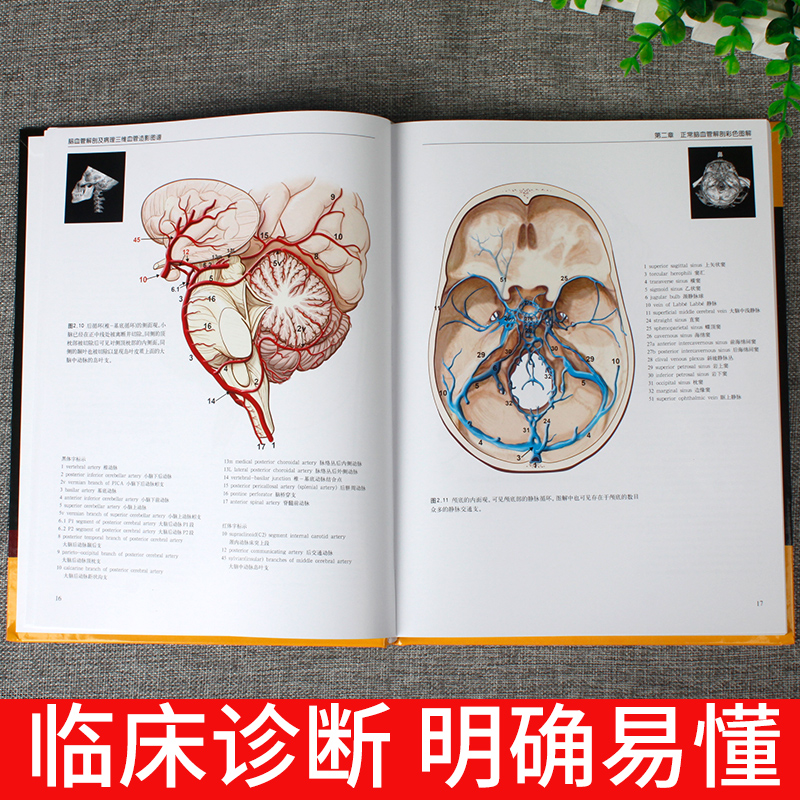 [正版] 脑血管解剖及病理三维血管造影图谱 人体脑血管解剖学图谱 神经外科医生技术参考书 颈部颅内动脉静脉医学书 脑血高清大图