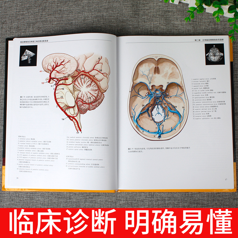[正版] 脑血管解剖及病理三维血管造影图谱 人体脑血管解剖学图谱 神经外科医生技术参考书 颈部颅内动脉静脉医学书 脑血