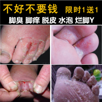 澳福来AO FU LAI脚爽喷剂85ml 去香港脚臭脚气脚底脱皮痒水泡糜烂脚丫脚汗脚裂护足霜