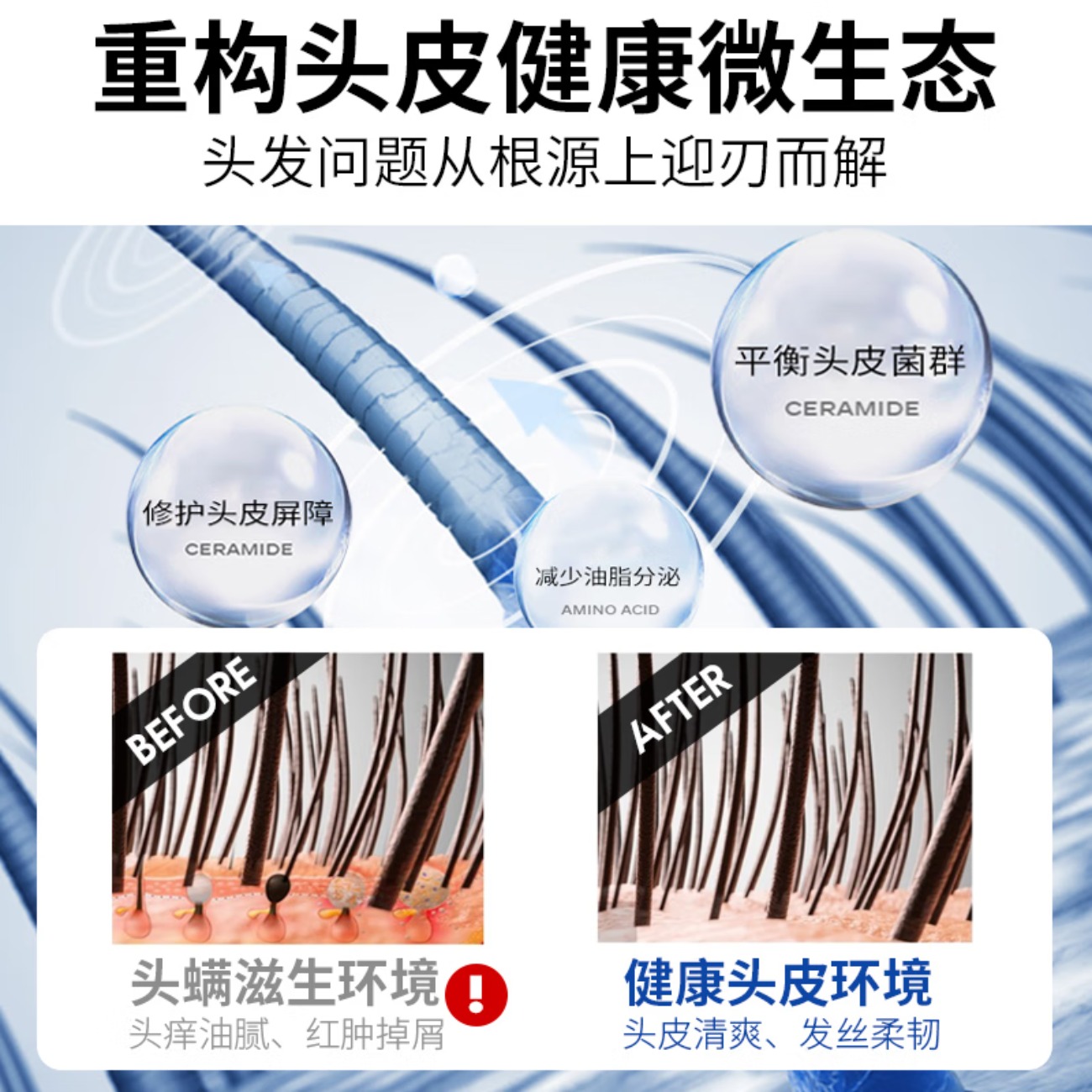绿色溪谷Greenkosy智能按摩腰带无线充电便携设计舒缓腰背疼痛绿色溪谷洗发水除螨虫海盐去屑控油男女士祛痘洗发露香氛洗高清大图