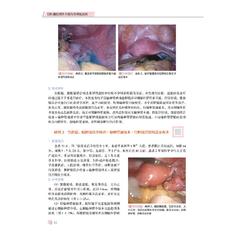 醉染图书妇科腹腔镜手术操作及精选实例9787559121400高清大图