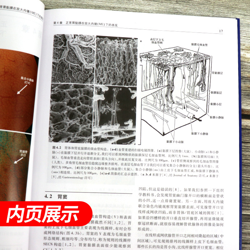 [正版]z/放大胃镜(精装彩图)八尾建史/原著 杨爱明 姚方/主译 人民卫生出版社/9787117207775