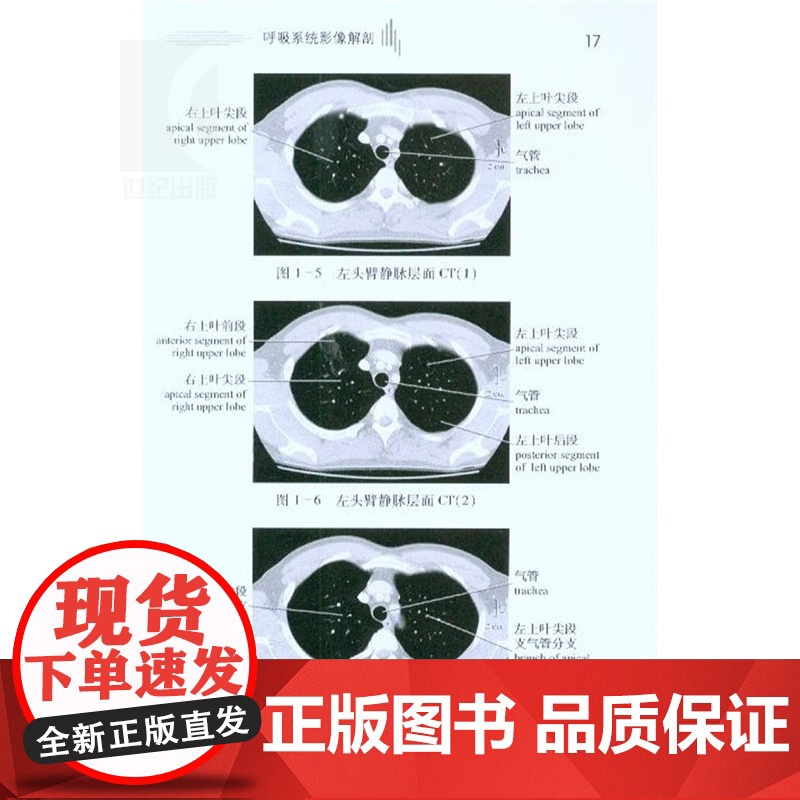 胸部影像解剖图谱/医学影像学解剖图谱丛书 李惠民 西医医学 医药卫生 上海科技 世纪出版高清大图