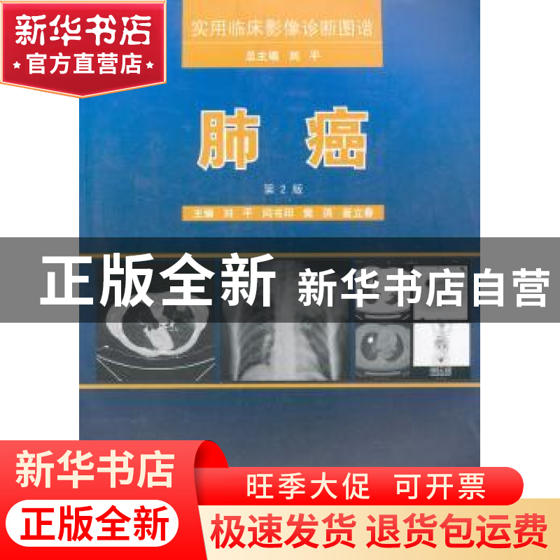 正版 肺癌 刘平【等】主编 第四军医大学出版社 9787566202802 书籍