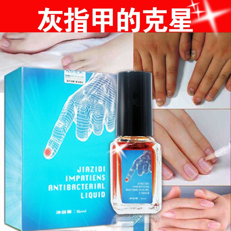 [医师推荐]治疗灰指甲特效去除增厚亮甲灰指甲专用液抑菌液 1瓶[5ml体验无]