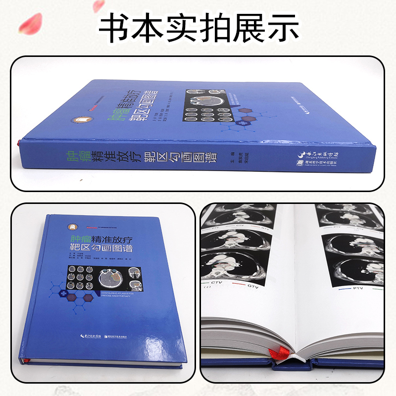 [正版] 肿瘤精准放疗靶区勾画图谱 主编袁双虎 宋启斌 肿瘤疾病临床案例诊治教程 内科学参考书籍 湖北科学技术出版社9