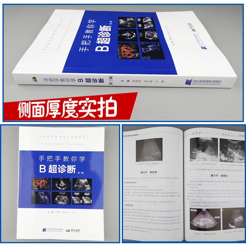 [醉染正版]临床医师影像手把手教你学 B超诊断 第三版 医学影像图谱 超声诊断学书籍 超声图像及鉴别诊断 超声检查技术手高清大图