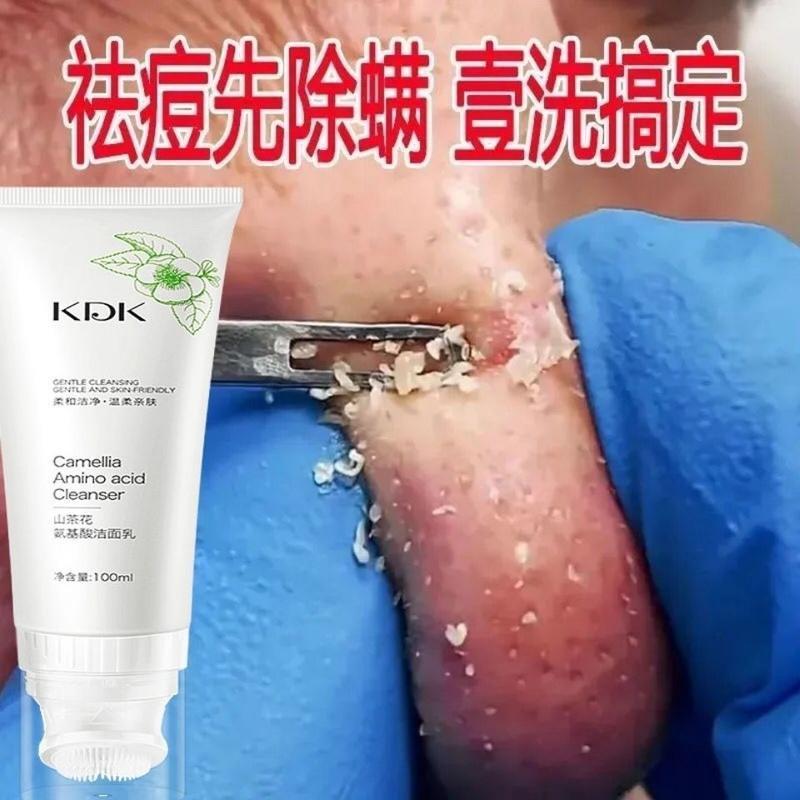 \氨基酸洁面乳 1瓶/ 氨基酸去痘洗面奶亮白除螨祛痘去黑头男女深层清洁控油洁面乳保湿