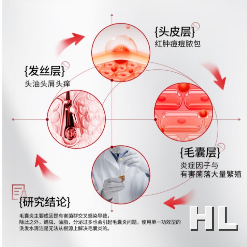 RUYI儒意二硫化硒去屑控油洗发水800g高清大图