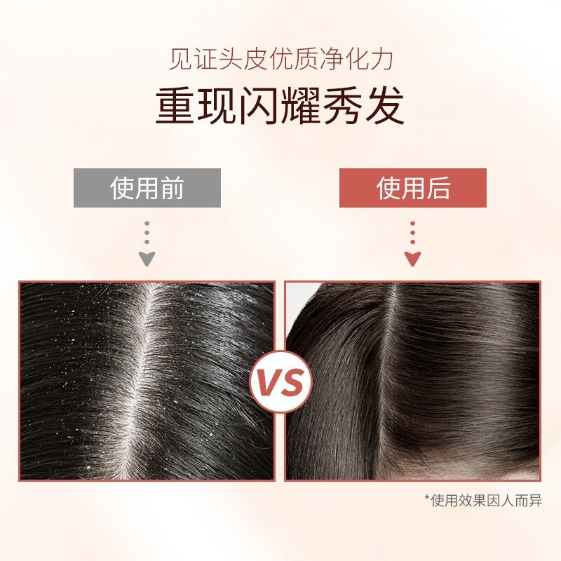 滋源535ml茶籽水润去屑洗头水(中干性)