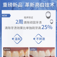 Waterpik洁碧家用冲牙器亮白去渍洗牙器水牙线去牙结石GT5-1
