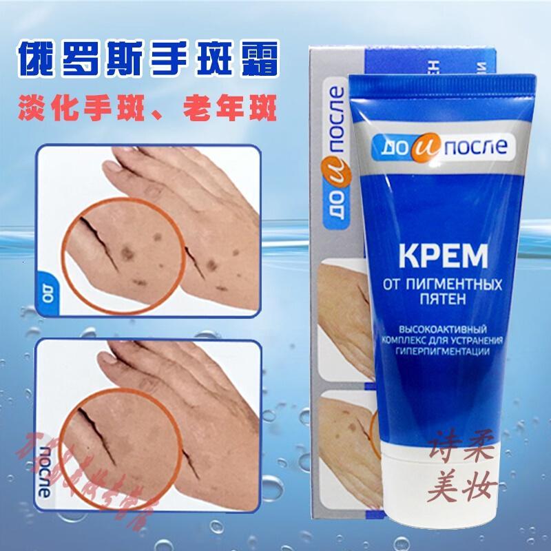 去除手上老年斑去手上老年斑手部手背专用俄罗斯kpem护手霜祛除老人斑