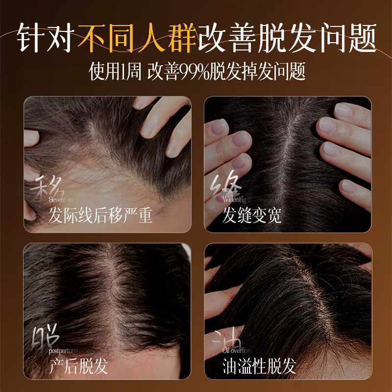 RUYI儒意防脱固根洗发水500g高清大图