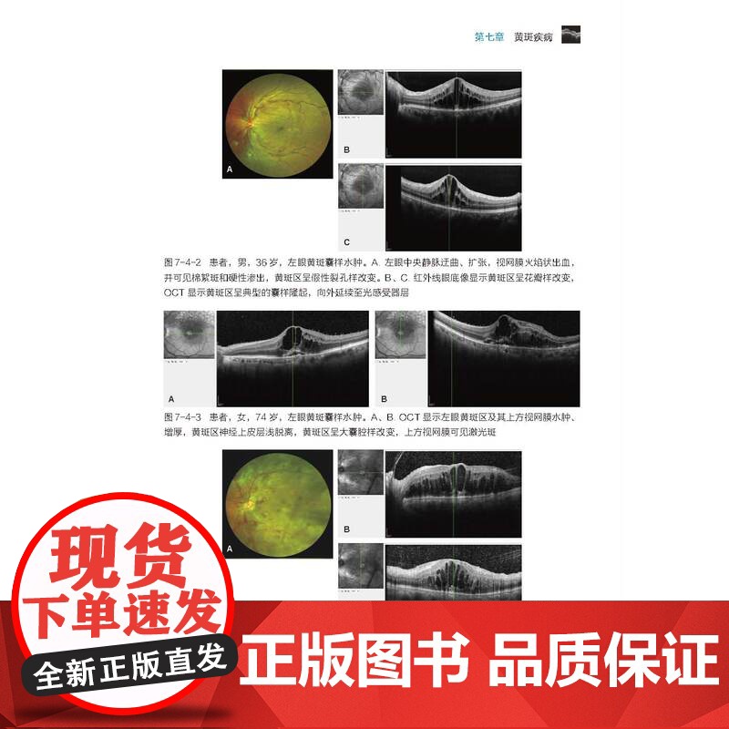 简明眼科相干光断层扫描操作阅片手册 图文并茂 病例分析 北京科学技术高清大图