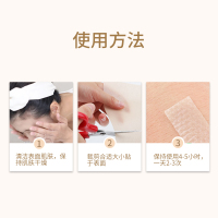 爱护佳新款医用疤痕贴祛疤膏1盒双眼皮剖腹产儿童烫伤修复痘印增生3*10CM
