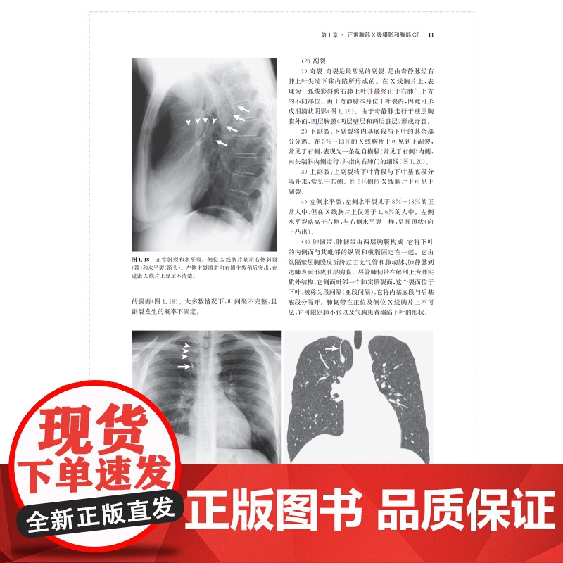 胸部影像学第2版 影像学大师系列上海科学技术出版社影像医学正版工具书高清大图