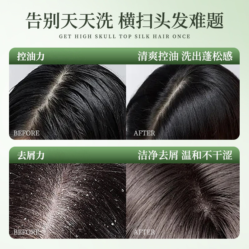 雪贝卡茶树植萃控油去屑洗发水高清大图