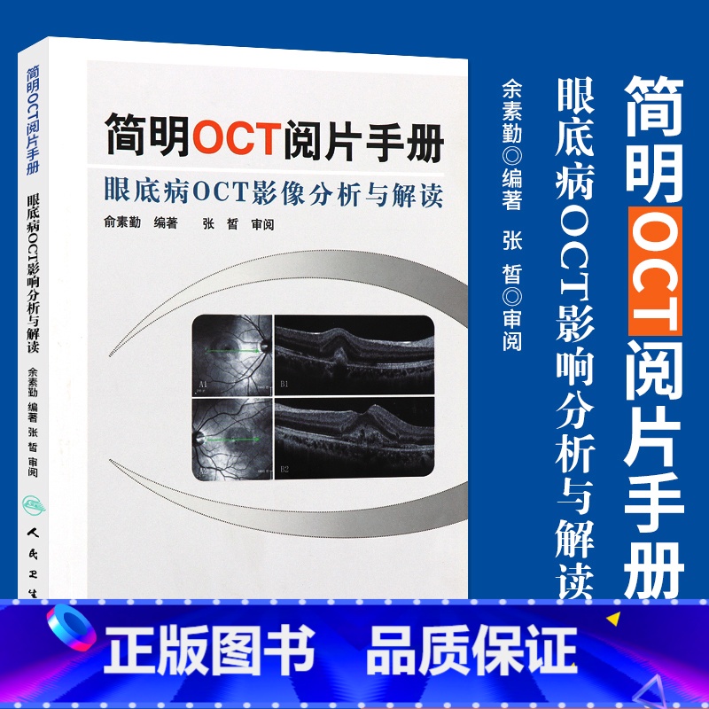 【正版】 简明OCT阅片手册 眼底病眼科OCT影像分析与解读 俞素勤编著 基础阅片影像眼科学视光技术应用 人民卫生出版